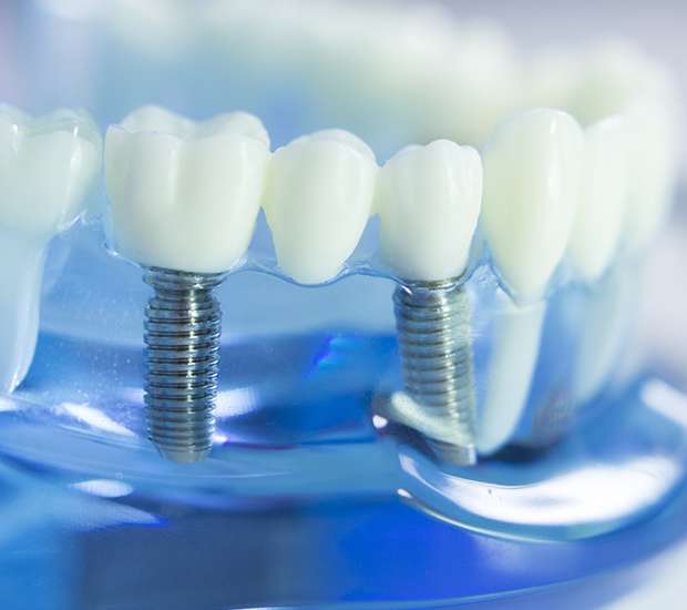 Wayne Dental Implants