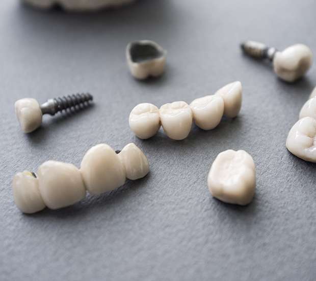 Wayne The Difference Between Dental Implants and Mini Dental Implants